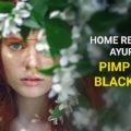 Home Remedies in Ayurveda for Pimples