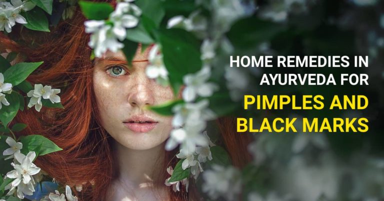 Ayurvedic Treatment for Pimples and Black Marks