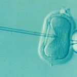about ivf and icsi- content img2
