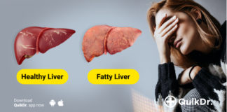 good diet for fatty liver