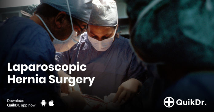 Hernia surgery in Kerala | quikdr