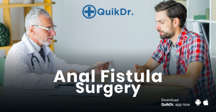 anal fistula surgery