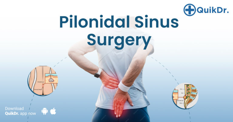 Pilonidal Sinus Surgery Kochi
